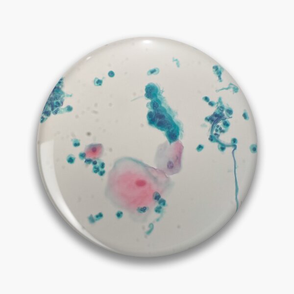 Item preview, Respiratory washing cytology designed and sold by CellPathWorld.