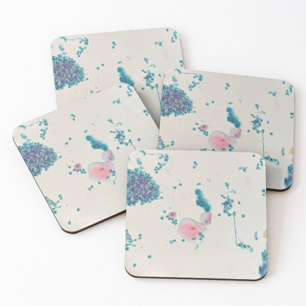 Item preview, Respiratory washing cytology designed and sold by CellPathWorld.