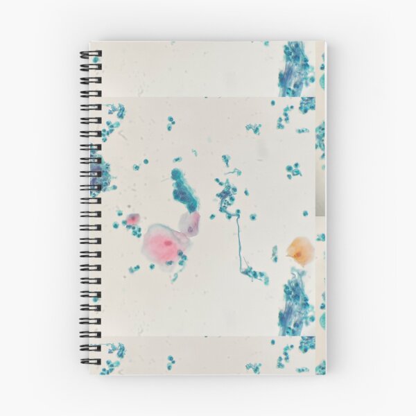 Item preview, Respiratory washing cytology designed and sold by CellPathWorld.