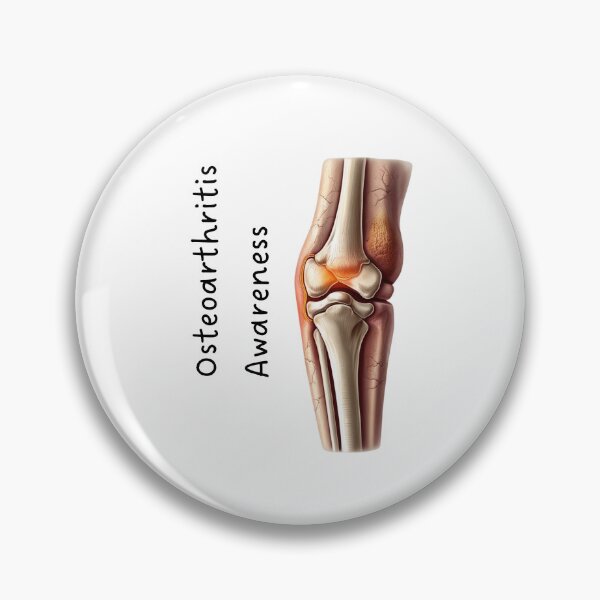 Artikelvorschau, Osteoarthritis-Bewusstsein – Einfaches und wirkungsvolles Arthritis-Design entworfen und verkauft von RM-Journey.