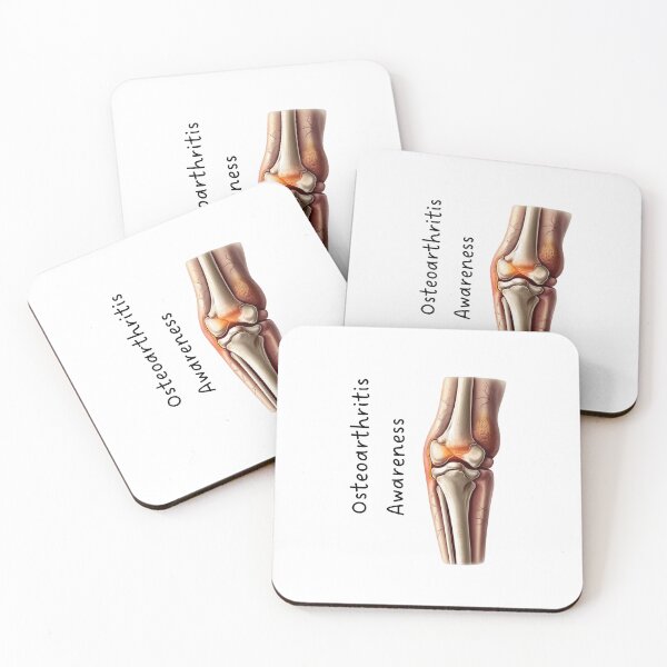 Item preview, Osteoarthritis Awareness – Simple & Powerful Arthritis Design designed and sold by RM-Journey.
