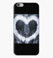 COLONHEART — XRAY iPhone Case