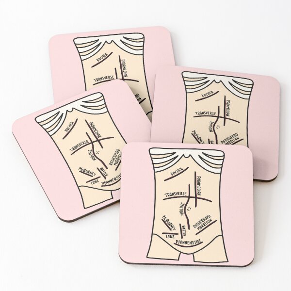 Item preview, Hand Drawn Abdominal Incisions designed and sold by SofiaSava01.