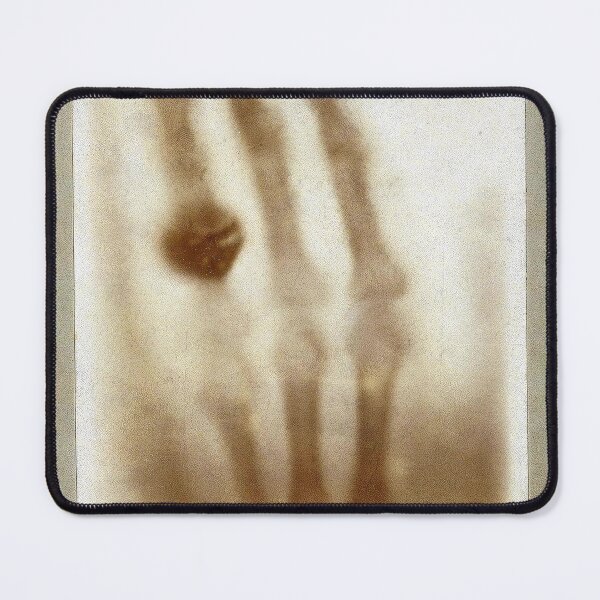 Item preview, First xray ever taken designed and sold by Brendon987.