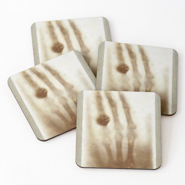 Item preview, First xray ever taken designed and sold by Brendon987.
