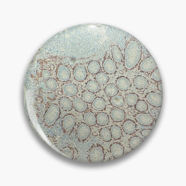 Item preview, IHC Smooth Muscle Actin in Colon designed and sold by CellPathWorld.
