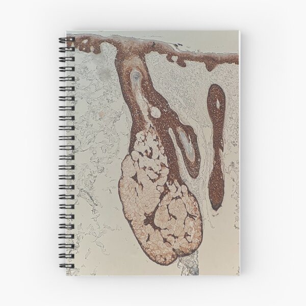 Item preview, Cytokeratins 5 and 6 - skin designed and sold by CellPathWorld.