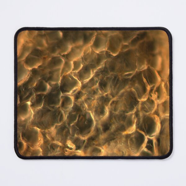 Item preview, Carrot cells in dark field at 50x designed and sold by VeiledDepths.