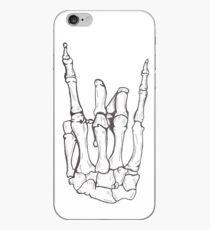 Rock iPhone Case