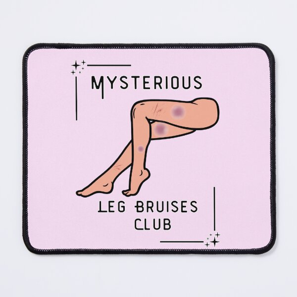 Item preview, Mysterious leg Bruises club designed and sold by mclaurin612.