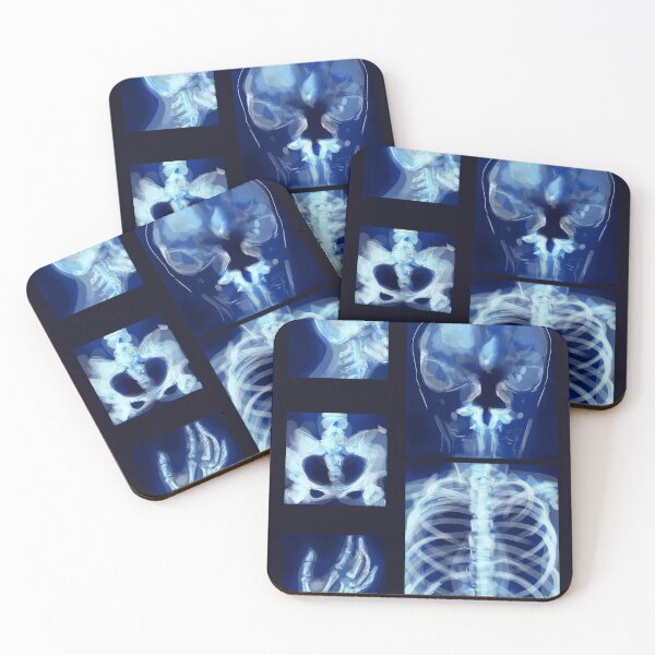 Item preview, X-rays designed and sold by Kewd.