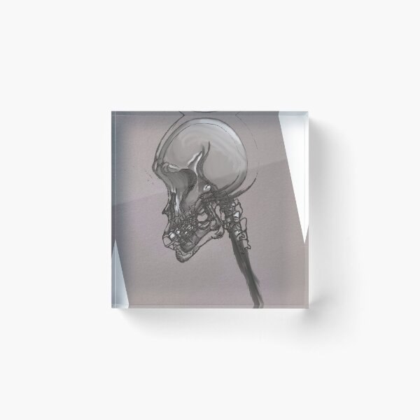 Item preview, Wonky skull designed and sold by Glenbobagins.