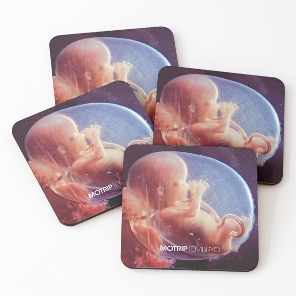 Artikelvorschau, MoTrip - Embryo-Album 2012 entworfen und verkauft von CindyDaviseno.