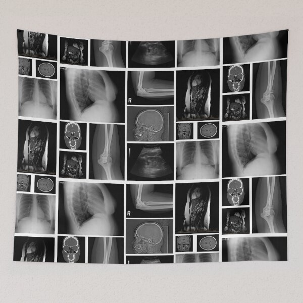 Item preview, Trapped in my Body - X-Ray designed and sold by aimeewilson.