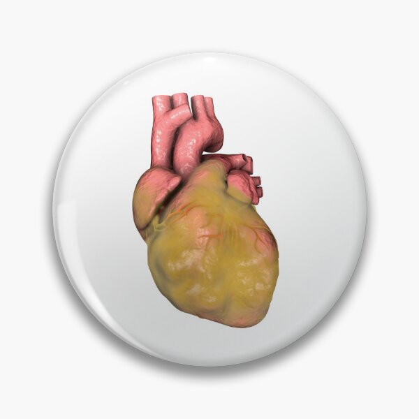 Item preview, Obese Human Heart designed and sold by Kateryna Kon.
