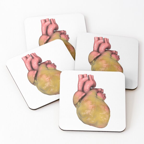 Item preview, Obese Human Heart designed and sold by Kateryna Kon.