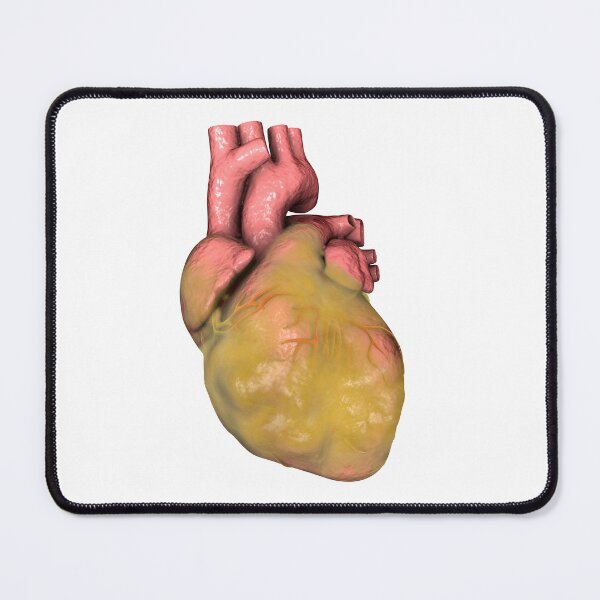 Item preview, Obese Human Heart designed and sold by Kateryna Kon.