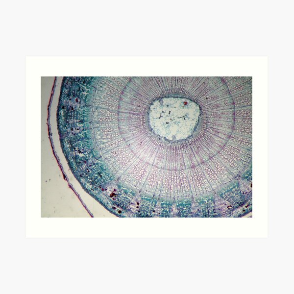 Microscope Slide - Dyed Stem Cross Section Art Print