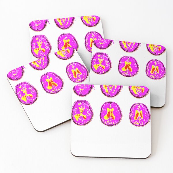 Item preview, Brain Scan Mri Images Of Human Brain designed and sold by lacnghia9645f.