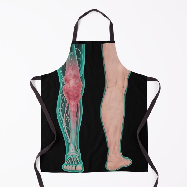 Item preview, Lymphedema designed and sold by Uglyandcute.