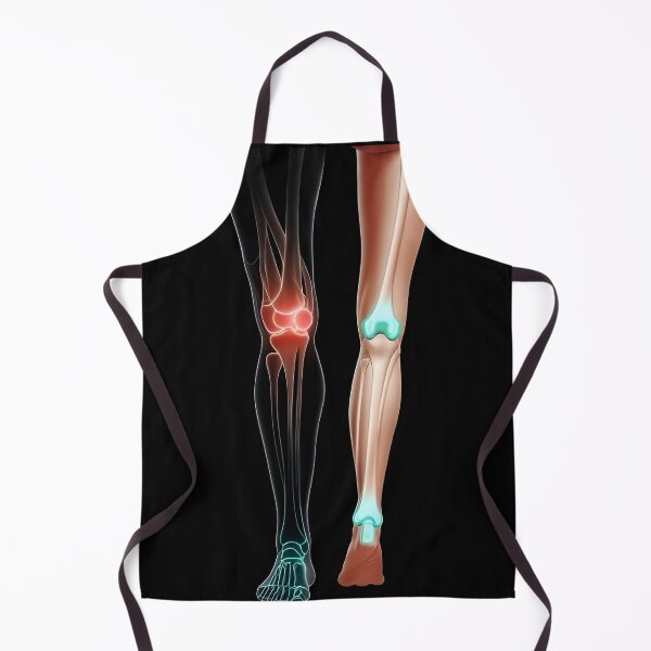 Item preview, Lymphedema designed and sold by Uglyandcute.