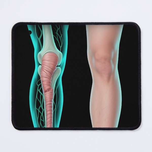 Item preview, Lymphedema designed and sold by Uglyandcute.