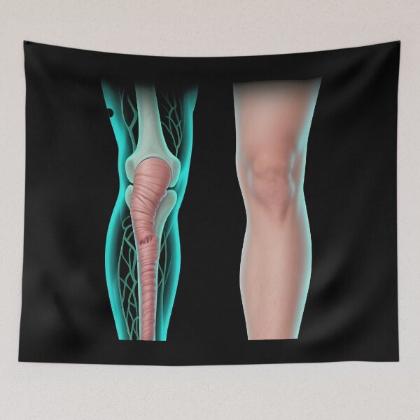 Item preview, Lymphedema designed and sold by Uglyandcute.