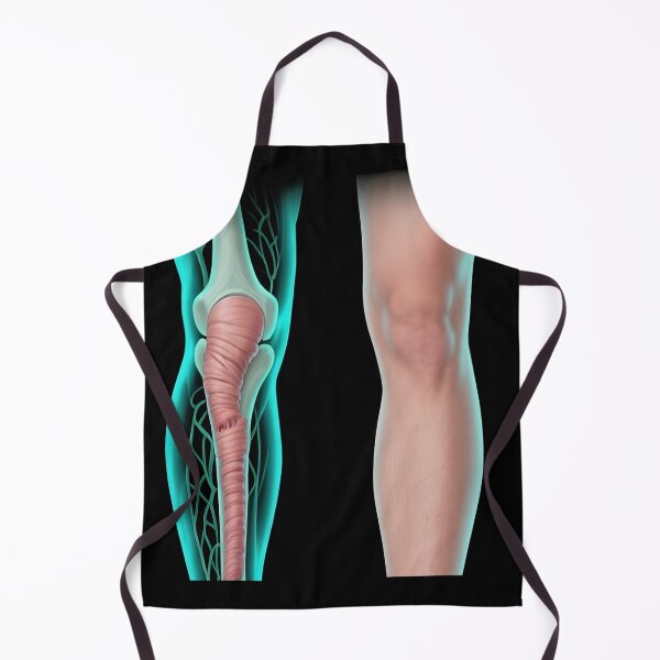 Item preview, Lymphedema designed and sold by Uglyandcute.