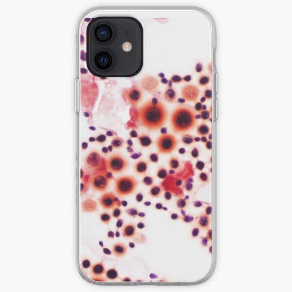 Cryptococcus neoformans iPhone Soft Case