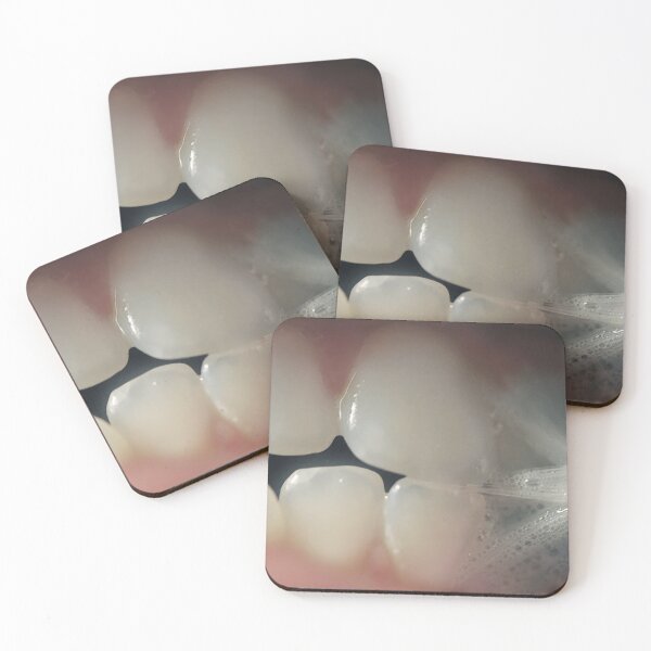 Item preview, Teeth designed and sold by SeenThruTheFog.