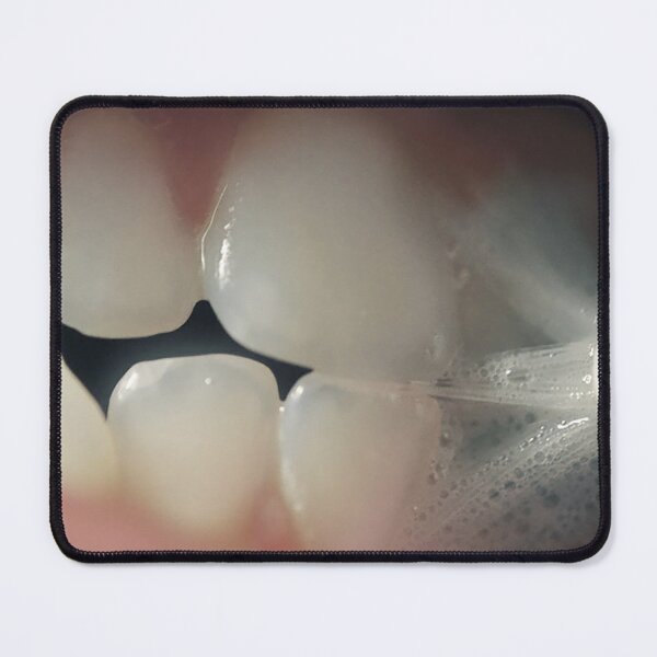 Item preview, Teeth designed and sold by SeenThruTheFog.