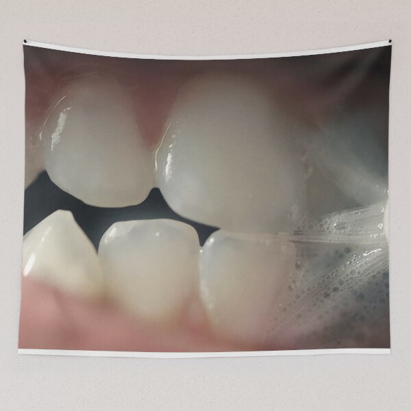 Item preview, Teeth designed and sold by SeenThruTheFog.