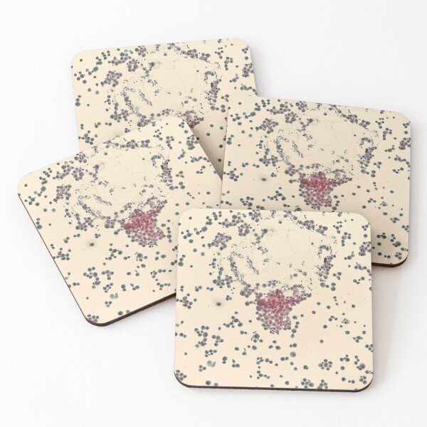 Item preview, Bronchoalveolar lavage cytology designed and sold by CellPathWorld.