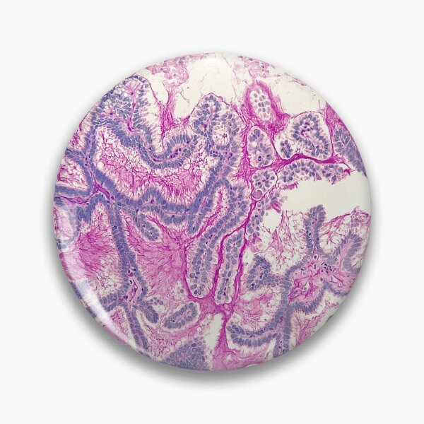 Item preview, Diastase PAS in colon biopsies designed and sold by CellPathWorld.
