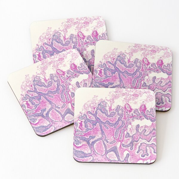 Item preview, Diastase PAS in colon biopsies designed and sold by CellPathWorld.
