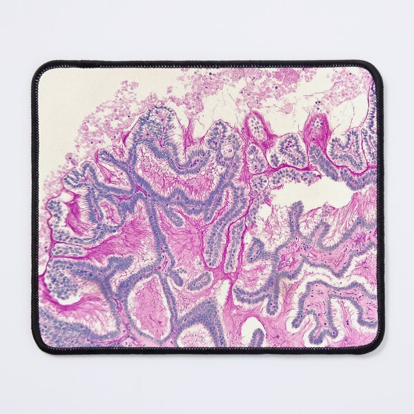 Item preview, Diastase PAS in colon biopsies designed and sold by CellPathWorld.