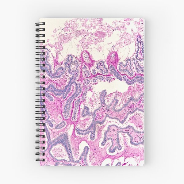 Item preview, Diastase PAS in colon biopsies designed and sold by CellPathWorld.