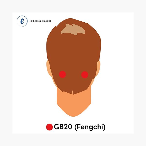 Item preview, Fengchi Acupoint Chart (GB20) – Gateway of Wind Epoch® Lasers Holistic Approach  designed and sold by Epoch-Lasers.