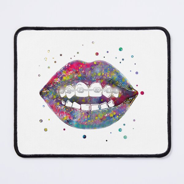 Item preview, Teeth braces-dental anatomy designed and sold by Rosaliartbook.