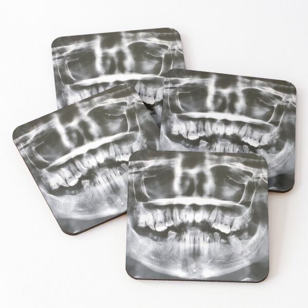 Item preview, A real xray designed and sold by AncientDreamer.