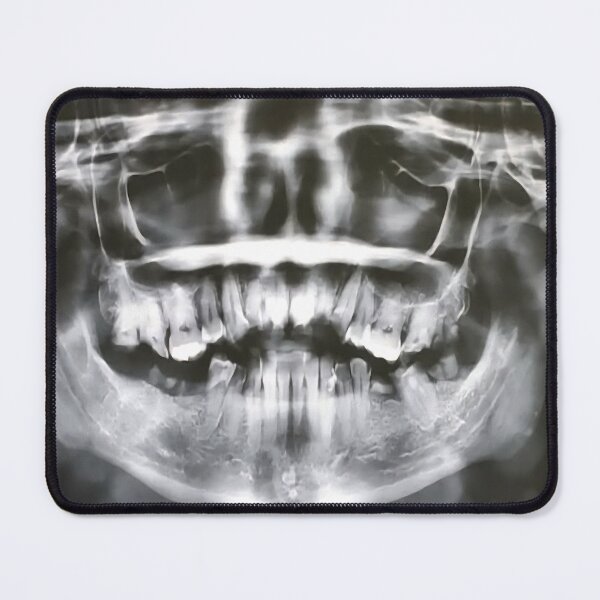 Item preview, A real xray designed and sold by AncientDreamer.