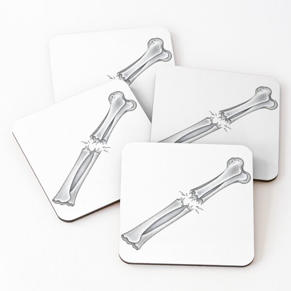 Item preview, Broken Bone designed and sold by Naux | Design & Illustration.