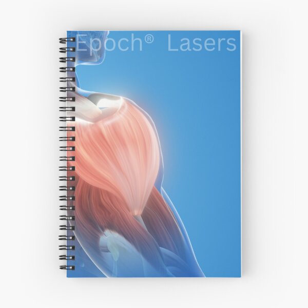 Item preview, Class 4 Laser Therapy for Pain with Epoch Lasers designed and sold by Epoch-Lasers.