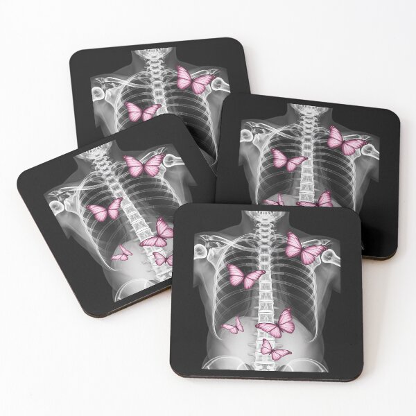 Item preview, Butterflies in My Stomach designed and sold by FranzFriesen.