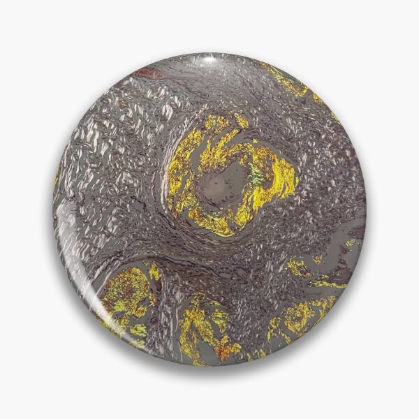 Item preview, Congo red amyloid designed and sold by CellPathWorld.