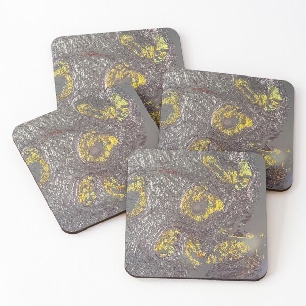 Item preview, Congo red amyloid designed and sold by CellPathWorld.