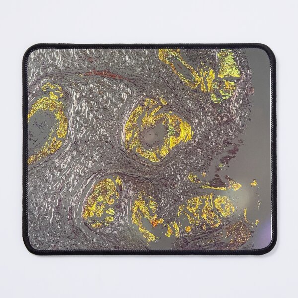 Item preview, Congo red amyloid designed and sold by CellPathWorld.