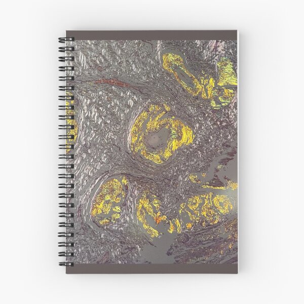Item preview, Congo red amyloid designed and sold by CellPathWorld.