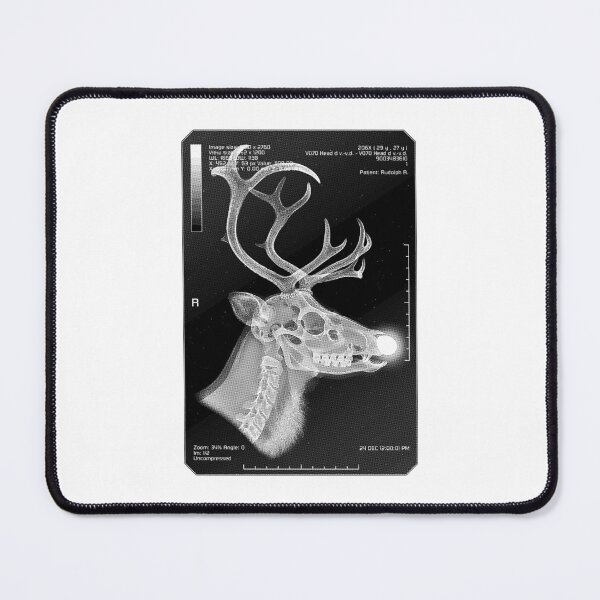 Item preview, Radiology Nurse Radiologist Funny Christmas X-Ray Reindeer designed and sold by GrandeDuc.