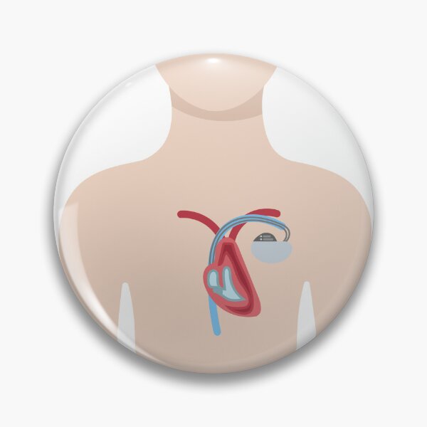 Item preview, Upper Body with Pacemaker Illustration designed and sold by EmeraldeaArt.